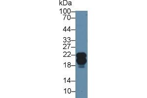 Western blot analysis of Human A549 cell lysate, using Rabbit Anti-Human CAV1 Antibody (2 µg/ml) and HRP-conjugated Goat Anti-Rabbit antibody (abx400043, 0. (Caveolin-1 抗体  (AA 2-104))