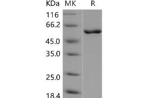 Western Blotting (WB) image for Calcium/calmodulin-Dependent Protein Kinase IV (CAMK4) protein (ABIN7320128) (CAMK4 蛋白)