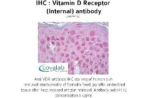 Image no. 1 for anti-Vitamin D Receptor (VDR) (Internal Region) antibody (ABIN1740731) (Vitamin D Receptor 抗体  (Internal Region))