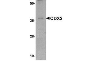 Western blot analysis of CDX2 in mouse brain tissue lysate with AP30223PU-N CDX2 antibody at 1 μg/ml. (CDX2 抗体  (C-Term))