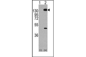 Image no. 1 for anti-Platelet Derived Growth Factor Receptor alpha (PDGFRA) (Tyr768) antibody (ABIN359912) (PDGFRA 抗体  (Tyr768))