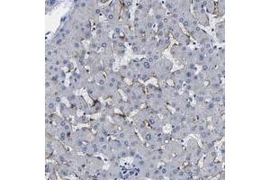 Immunohistochemical staining of human liver with CLEC4G polyclonal antibody  shows distinct positivity in sinusoids.