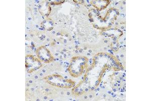 Immunohistochemistry of paraffin-embedded rat kidney using SYNPO antibody at dilution of 1:100 (x40 lens). (SYNPO 抗体)