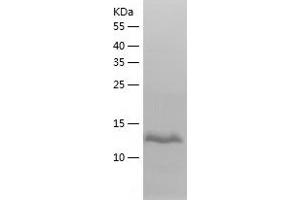 Western Blotting (WB) image for Activin A (ACVA) (AA 309-424) protein (His tag) (ABIN7121673)
