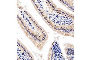 Immunohistochemistry of paraffin embedded mouse jejunum using SLC7A8 (ABIN7074503) at dilution of 1:1100 (400x lens) (LAT2 抗体)