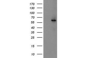Western Blotting (WB) image for anti-Cytochrome P450, Family 2, Subfamily J, Polypeptide 2 (CYP2J2) antibody (ABIN1497730) (CYP2J2 抗体)