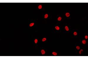ABIN6269020 staining 293 by IF/ICC. (TBP 抗体  (N-Term))