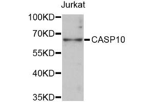 Western blot analysis of extracts of Jurkat cells, using CASP10 antibody (ABIN1871452) at 1:3000 dilution. (Caspase 10 抗体)