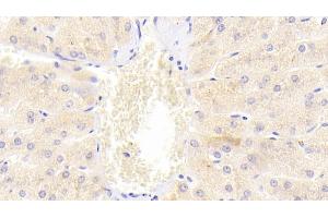Detection of DR5 in Human Liver Tissue using Polyclonal Antibody to Death receptor 5 (DR5) (TNFRSF10B 抗体  (AA 234-435))