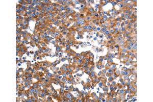 Immunohistochemistry (IHC) image for anti-Inner Membrane Protein, Mitochondrial (IMMT) (AA 120-270) antibody (ABIN3016602) (IMMT 抗体  (AA 120-270))