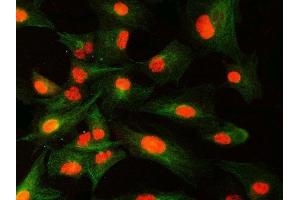 IF analysis of SNRNP40 and Tubulin beta using anti-SNRNP40 antibody (ABIN7601719) and anti-Tubulin beta antibody (ABIN7602744). (SNRNP40 抗体  (AA 43-357))