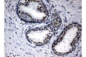 Image no. 1 for anti-Nibrin (NBN) (AA 461-754) antibody (ABIN1491540) (Nibrin 抗体  (AA 461-754))