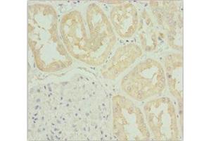 Immunohistochemistry of paraffin-embedded human kidney tissue using ABIN7171763 at dilution of 1:100 (TNS3 抗体  (AA 1-240))