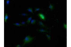 Immunofluorescence staining of U251 cells with ABIN7147821 at 1:150, counter-stained with DAPI. (Clarin 2 抗体  (AA 31-100))