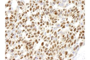 Immunohistochemistry (IHC) image for anti-Ribosomal Protein L26 (RPL26) (C-Term) antibody (ABIN7448782) (RPL26 抗体  (C-Term))