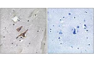 Immunohistochemistry analysis of paraffin-embedded human brain, using TSC2 (Phospho-Tyr1571) Antibody. (Tuberin 抗体  (pTyr1571))