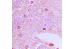 Immunohistochemistry (IHC) image for anti-TAF6-Like RNA Polymerase II, P300/CBP-Associated Factor (PCAF)-Associated Factor, 65kDa (TAF6L) (N-Term) antibody (ABIN7297814)