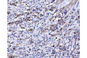 IHC analysis of DHODH using anti-DHODH antibody (ABIN7603139). (DHODH 抗体  (N-Term))
