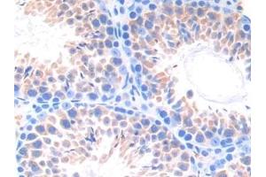 Immunohistochemistry (IHC) image for anti-Cytochrome P450, Family 21, Subfamily A, Polypeptide 2 (CYP21A2) (AA 37-264) antibody (ABIN7441889)
