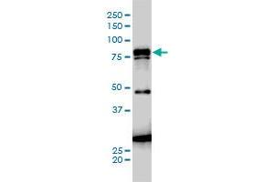 JUP monoclonal antibody (M01A), clone 1D5 Western Blot analysis of JUP expression in A-431 . (JUP 抗体  (AA 1-745))