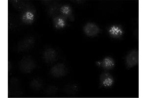 Image no. 1 for anti-Centromere Protein E, 312kDa (CENPE) antibody (ABIN341075) (CENPE 抗体)