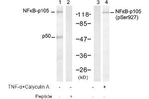Image no. 1 for anti-Nuclear Factor of kappa Light Polypeptide Gene Enhancer in B-Cells 1 (NFKB1) (pSer927) antibody (ABIN319253) (NFKB1 抗体  (pSer927))