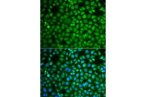 Immunofluorescence analysis of A549 cells using ZNF346 antibody (ABIN5975303). (ZNF346 抗体)