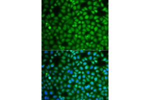 Immunofluorescence analysis of A549 cells using ZNF346 antibody (ABIN5975303). (ZNF346 抗体)
