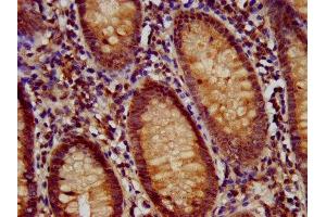 IHC image of ABIN7159682 diluted at 1:700 and staining in paraffin-embedded human appendix tissue performed on a Leica BondTM system. (RFX1 抗体  (AA 36-133))