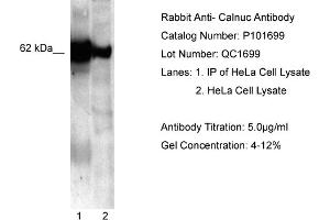 WB Suggested Anti-NUCB1  Antibody Titration: 5. (Nucleobindin 1 抗体  (C-Term))