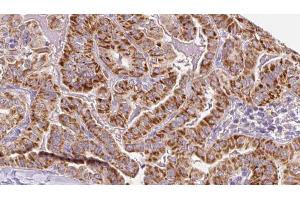anti-Ryanodine Receptor 2 (Cardiac) (RYR2) (pSer2814) antibody