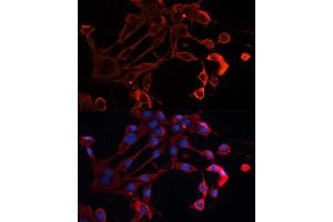 Immunofluorescence analysis of NIH/3T3 cells using  antibody (ABIN7265433) at dilution of 1:100. (ADAM11 抗体  (AA 290-430))