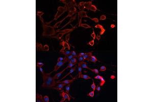 Immunofluorescence analysis of NIH/3T3 cells using  antibody (ABIN7265433) at dilution of 1:100. (ADAM11 抗体  (AA 290-430))