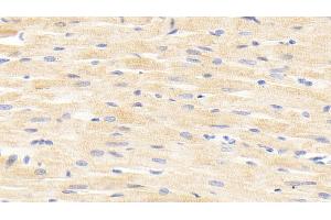 Detection of ANGPTL4 in Rat Cardiac Muscle Tissue using Polyclonal Antibody to Angiopoietin Like Protein 4 (ANGPTL4) (ANGPTL4 抗体  (AA 182-394))
