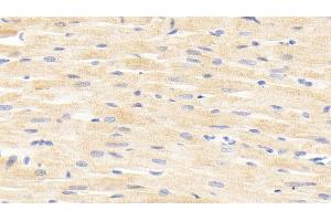 Detection of ANGPTL4 in Rat Cardiac Muscle Tissue using Polyclonal Antibody to Angiopoietin Like Protein 4 (ANGPTL4) (ANGPTL4 抗体  (AA 182-394))