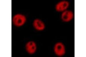Immunofluorescence (fixed cells) (IF/ICC) image for anti-Heterogeneous Nuclear Ribonucleoprotein M (HNRNPM) (N-Term) antibody (ABIN6262326)