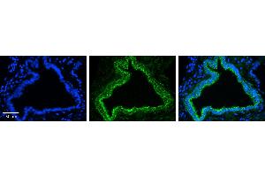 Immunohistochemistry (IHC) image for anti-Ras Homolog Family Member D (RHOD) (N-Term) antibody (ABIN2775403) (RHOD 抗体  (N-Term))