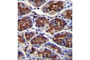 Formalin fixed and paraffin embedded human stomach tissue reacted with ABHD9 Antibody (C-term) followed by peroxidase conjugation of the secondary antibody and DAB staining. (ABHD9 抗体  (C-Term))