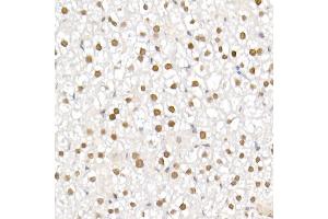 Immunohistochemistry of paraffin-embedded mouse liver using TCE Rabbit mAb (ABIN7270877) at dilution of 1:25 (40x lens).