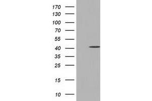 HEK293T cells were transfected with the pCMV6-ENTRY control (Left lane) or pCMV6-ENTRY CBWD1 (Right lane) cDNA for 48 hrs and lysed. (CBWD1 抗体)