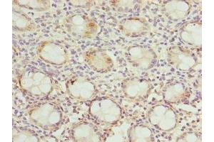 Immunohistochemistry of paraffin-embedded human colon tissue using ABIN7150532 at dilution of 1:100