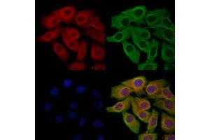 ABIN6265094 and ABIN6278291 staining Hela cells by IF/ICC. (SIRT5 抗体  (Internal Region))