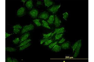 Immunofluorescence of monoclonal antibody to RAB9A on HeLa cell. (RAB9A 抗体  (AA 17-115))