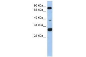 Image no. 1 for anti-Chromosome 1 Open Reading Frame 110 (C1ORF110) (AA 35-84) antibody (ABIN6743881) (C1ORF110 抗体  (AA 35-84))