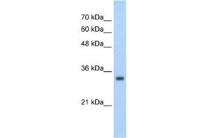 WB Suggested Anti-ZNF227 Antibody Titration:  2. (ZNF227 抗体  (Middle Region))