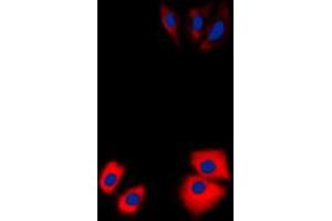 Immunofluorescent analysis of MARK2 staining in Jurkat cells. (MARK2 抗体  (N-Term))