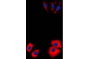 Immunofluorescent analysis of MARK2 staining in Jurkat cells.