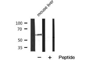 Western Blotting (WB) image for anti-Sequestosome 1 (SQSTM1) (C-Term) antibody (ABIN6263985)