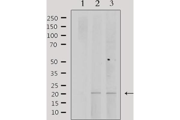 PPP1R14C 抗体  (Internal Region)