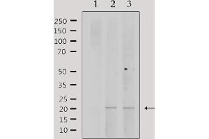 Western blot analysis of extracts from various samples, using PPP1R14C Antibody. (PPP1R14C 抗体  (Internal Region))